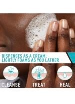 CeraVe Acne Foaming Cream Cleanser 4% Benzoyl Peroxide - Image 3